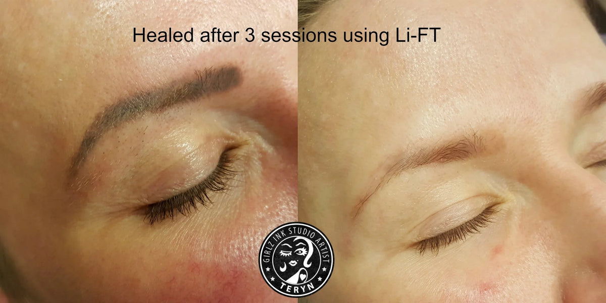LiFT Saline Tattoo Lightening Solution- 15ml