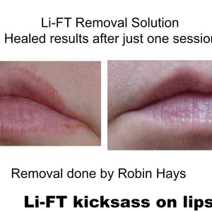 LiFT Saline Tattoo Lightening Solution- 15ml